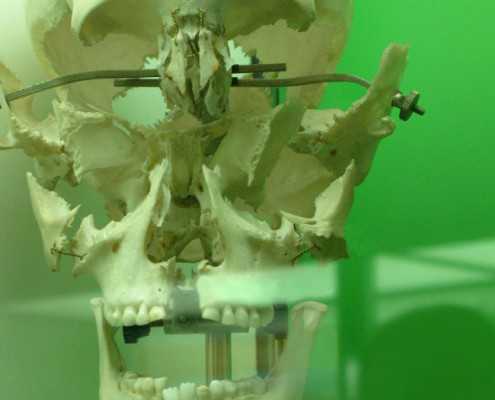 Cristina Treppo, “Reperto osseo”, 2008